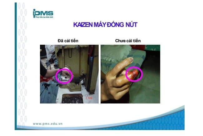 Ví dụ về Kaizen đóng nút